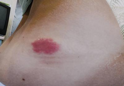 爱游戏官方-黄蜂后卫意外发现左腿有伤痕，球队医疗组已介入的简单介绍