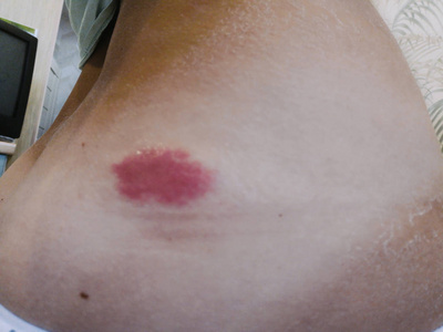 黄蜂后卫意外发现左腿有伤痕,球队医疗组已介入的简单介绍 黄蜂后卫意外发现左腿有伤痕,球队医疗组已介入的简单介绍